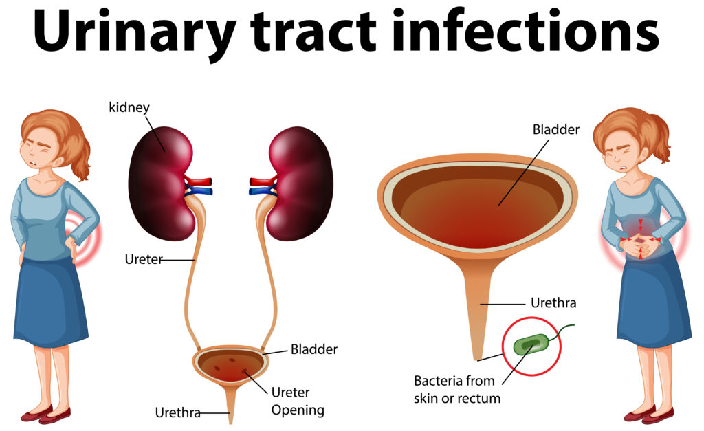 Routine Urine tests can help identify a Urinary tract Infection