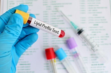 What is a Lipid profile test and when is it done?